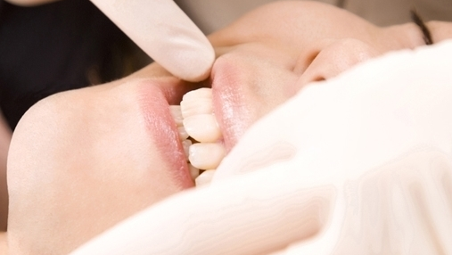 市原市・五井駅の親知らずの抜歯・治療