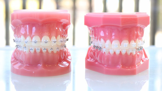 市原市・五井駅の小児矯正