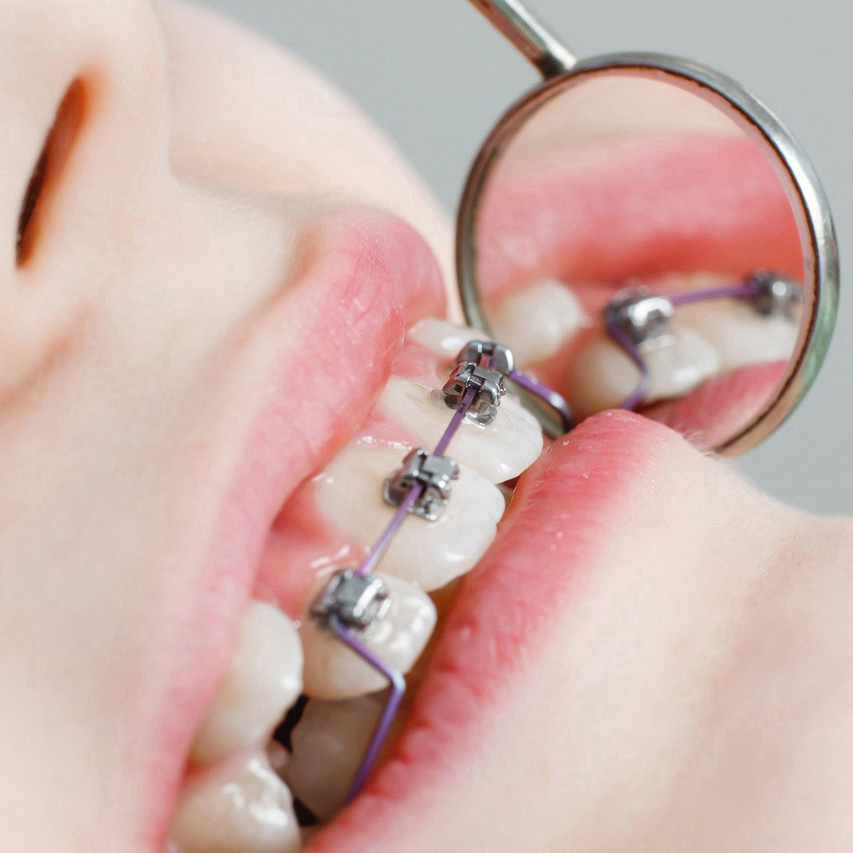 市原市・五井駅の部分矯正