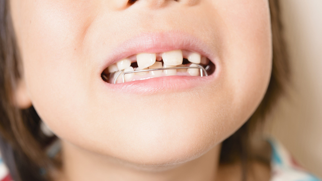 市原市・五井駅の小児矯正